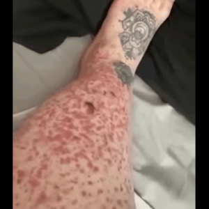 These are the consequences of sleeping with These are the consequences of sleeping with