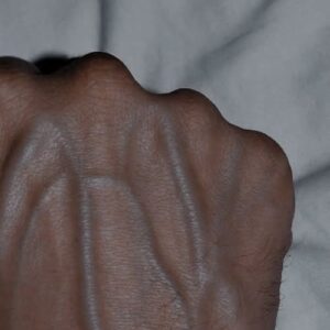 If your veins are visible in your hand, it is a signal of ca… See more👇🏻