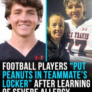 Football players “deliberately put peanuts in severely allergic teammate’s locker”