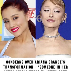 Ariana Grande’s transformation sparks concern
