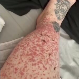 These are the consequences of sleeping with…See more