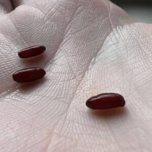 Man Died from Tick-Borne Vir