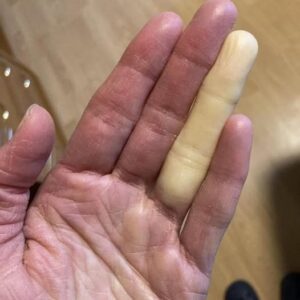 These are the consequences of sleeping with the… See more