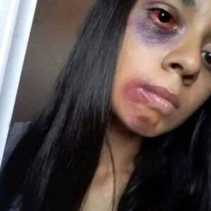 Young woman dies at the hands of her…