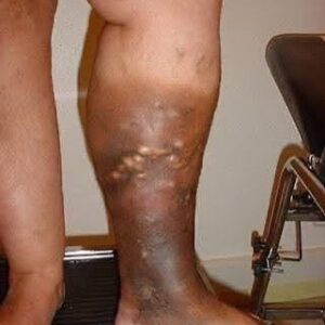 These are the first symptoms of a… See more