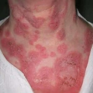 These are the consequences of sleeping with the… See more