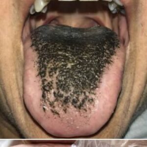 These are the consequences of sleeping with the… Seee more