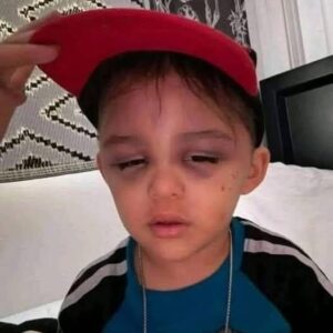 A 3-year-old boy …