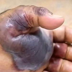 ATTENTION to these first signs of…See More