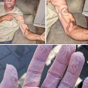 A man goes to stretch and ends up feeling a sharp pain in his arm, it was a ca…