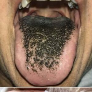 These are the consequences of sleeping with the… See more