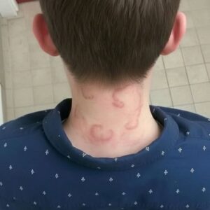 My 8 year old son been having this for 2 months straight it’s gotten worse from the first time he had this.. What is it