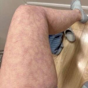 HT! These are the consequences of sleeping