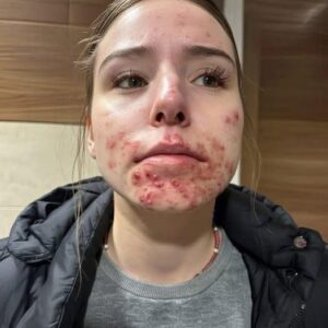 These are the consequences of sleeping with your c… See more