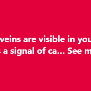 When to Worry About Veins That Appear Out of Nowhere