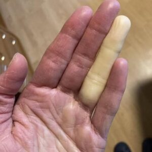 These are the consequences of sleeping co! See now!