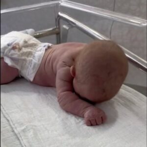 Baby born with an DIU peg… See more