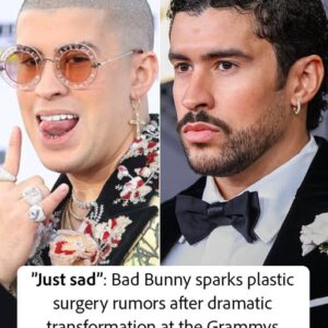 Bad Bunny sparks plastic surgery rumors after dramatic transformation at the Grammys