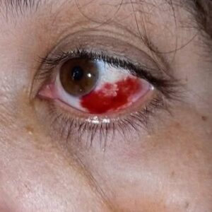 Be careful! These are the consequences of sleeping with the…