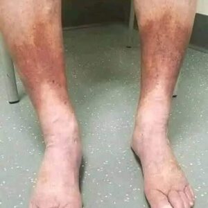 These are the first symptoms of a, See it!