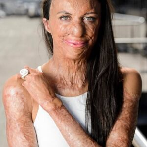 These are the consequences of sleeping co… See more