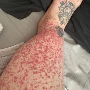 These are the consequences of sleeping with the…See more