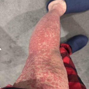 These are the consequences of sleeping with…See more