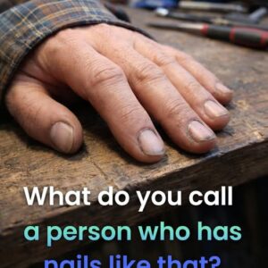 Before You Judge: What Dirty Nails Might Actually Mean