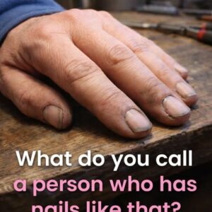 What Dirty Nails Really Say About a Person