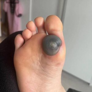 My daughter woke up with this huge