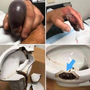 In several regions snakes…