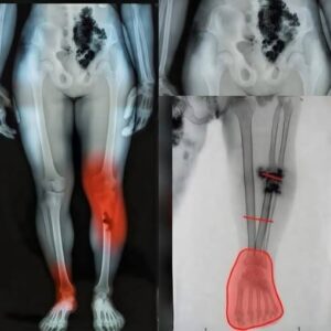 Health After Illness: Importan