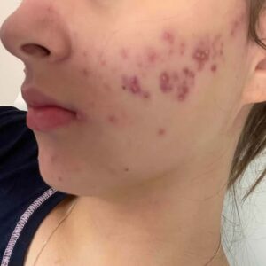 These are the consequences of sleeping with the…See more