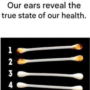 Our ears reveal our true state of health