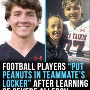 Football players “deliberately put peanuts in severely allergic teammate’s locker”