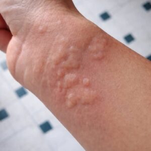 These are the consequences of sleeping with…