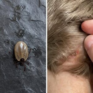 The Little Scalp Invader! 5 Common Bugs