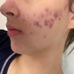 These are the consequences of sleeping with the…See more