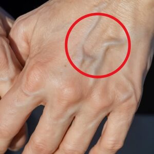 When Veins Start Whispering Back