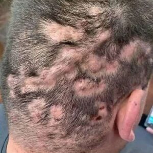 These are the first symptoms of sleeping with… See more