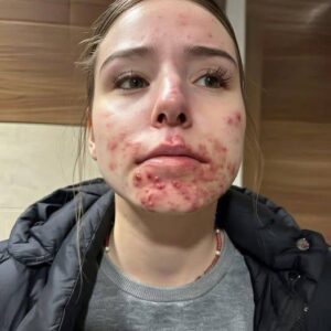 These are the consequences of sleeping with the…See more