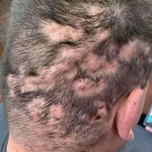 These are the first symptoms