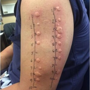 These are the consequences