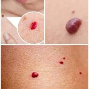 Small Red Dots on the Skin: What They Often Mean and When to Pay Attention