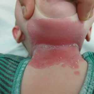 These are the consequences of sleeping with…