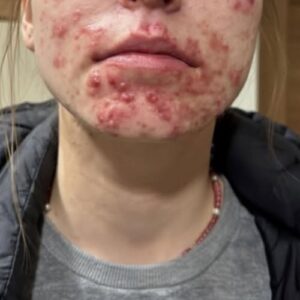 These are the consequences of sleeping with…