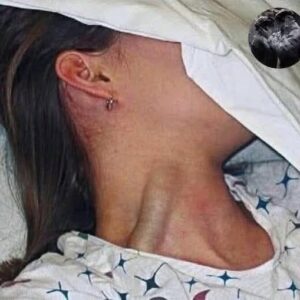 14-year-old teenager passed away after putting lamp on her pu…