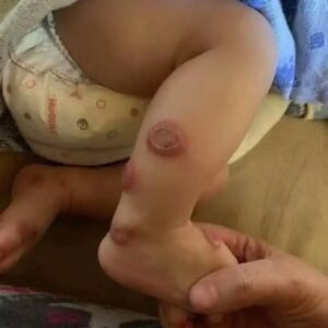 Body Alerts For Possible Health Issues