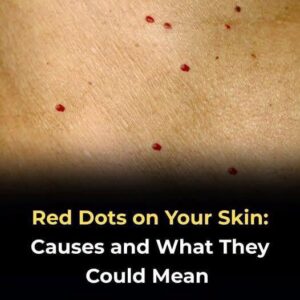 Red dots on your skin: Causes and what they could mean