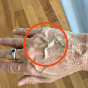 If you have visible veins it means you are…